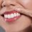 What is the best treatment for a gummy smile?